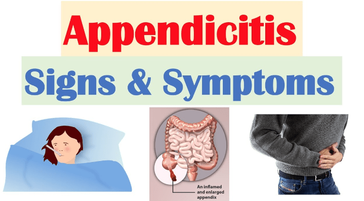Appendicitis Symptoms